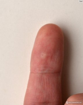 手指指纹图 原图